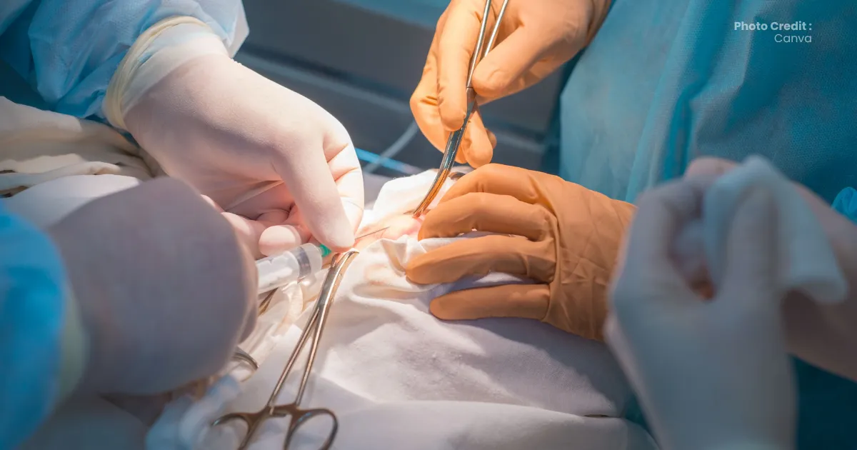 Dokter Spesialis Bedah Anak di Banda Aceh: Panduan Lengkap Kapan Anak Perlu Operasi